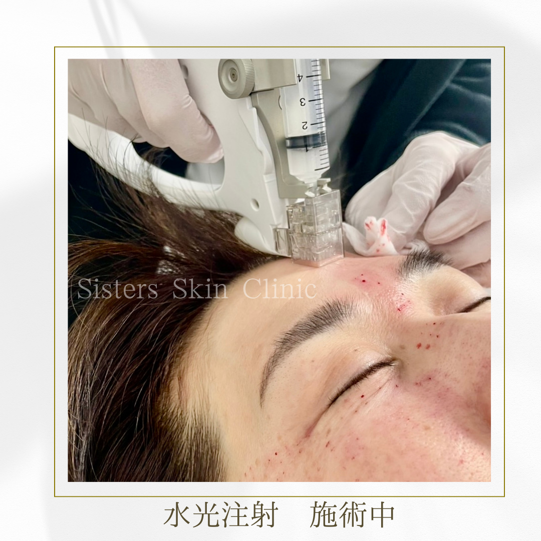 美容施術メニュー | 新着情報 | シスターズ皮フ科l岡山市中区